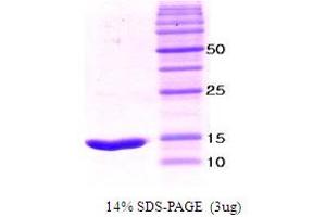 SDS-PAGE (SDS) image for Leukocyte-Associated Immunoglobulin-Like Receptor 1 (LAIR1) (AA 22-125), (Extracellular Domain) protein (ABIN666805) (LAIR1 Protein (AA 22-125, Extracellular Domain))