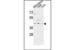 Western blot analysis of PRPF38A Antibody (C-term) in MDA-MB231,CEM,HL-60 cell line lysates (35ug/lane). (PRPF38A antibody  (C-Term))
