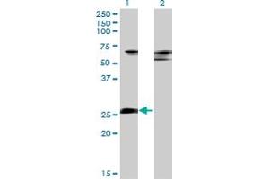 Western Blot analysis of ZNF266 expression in transfected 293T cell line by ZNF266 monoclonal antibody (M02), clone 4G5. (ZNF266 antibody  (AA 274-346))