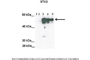 Lanes:   Lane1: 100ug untransfected COS-7 lysate Lane2: 100ug mock transfected Cos-7 lysate Lane3: 100ug STK3 transfected Cos-7 lysate Lane4: 50 ug STK3 transfected Cos-7 lysate Lane5: 25 ug STK3 transfected Cos-7 lysate  Primary Antibody Dilution:   1:2000  Secondary Antibody:   Anti-rabbit HRP  Secondary Antibody Dilution:   1:5000  Gene Name:   STK3  Submitted by:   Anonymous (STK3 antibody  (C-Term))