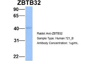 Host: Rabbit Target Name: WT1 Sample Type: 721_B Antibody Dilution: 1. (ZBTB32 antibody  (N-Term))