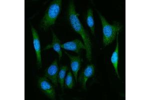 IF analysis of FAAH1/FAAH using anti-FAAH1/FAAH antibody (ABIN7601397). (FAAH antibody  (AA 34-579))