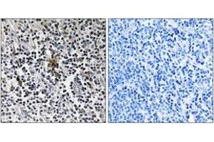 Immunohistochemistry analysis of paraffin-embedded human tonsil tissue, using RPS3 Antibody. (RPS3 antibody  (AA 171-220))