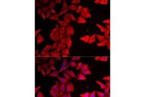 Immunofluorescence analysis of MCF7 cells using THRSP Polyclonal Antibody (THRSP antibody)