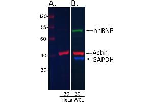 Western Blotting (WB) image for Donkey anti-Rabbit IgG (Heavy & Light Chain) antibody (DyLight 800) - Preadsorbed (ABIN7446401)