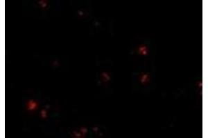 Immunofluorescence of LASS5 in human brain tissue with this product at 20 μg/ml. (LASS5 antibody  (C-Term))