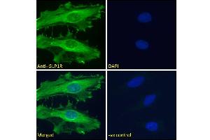 ABIN5539774 Immunofluorescence analysis of paraformaldehyde fixed HeLa cells, permeabilized with 0. (GLP1R antibody  (Internal Region))