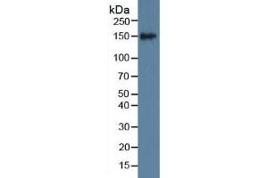 Rabbit Detection antibody from the kit in WB with Positive Control: Sample Mouse serum. (SLIT1 ELISA Kit)