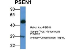 Host: Rabbit  Target Name: PSEN1  Sample Tissue: Human Adult Placenta  Antibody Dilution: 1. (Presenilin 1 antibody  (Middle Region))