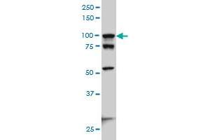 ACTN4 monoclonal antibody (M01A), clone 4D10 Western Blot analysis of ACTN4 expression in Hela S3 NE . (alpha Actinin 4 antibody  (AA 592-701))