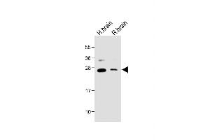 All lanes : Anti-NTF3 Antibody (C-term) at 1:2000 dilution Lane 1: Human brain lysate Lane 2: Rat brain lysate Lysates/proteins at 20 μg per lane. (Neurotrophin 3 antibody  (C-Term))