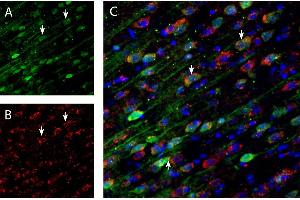 Immunohistochemical staining of perfusion-fixed frozen mouse frontal cortex brain sections with Anti-DARPP32 Antibody (ABIN7043569), (1:200), followed by goat anti-rabbit- and Guinea pig Anti-D1 Dopamine Receptor Antibody (ABIN7043106), (1:200), followed by goat anti-guinea pig-.