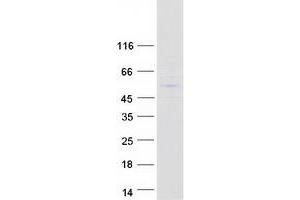 PRAME Family Member 19 (PRAMEF19) protein (Myc-DYKDDDDK Tag)