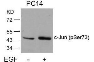 Western blot analysis of extracts from PC14 cells untreated or treated with EGF using c-Jun(Phospho-Ser73) Antibody. (C-JUN antibody  (pSer73))