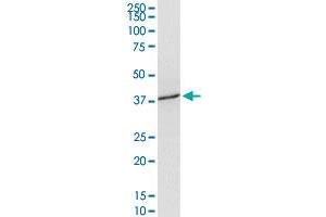 Western Blotting (WB) image for anti-Solute Carrier Family 39 (Zinc Transporter), Member 3 (SLC39A3) (AA 1-314) antibody (ABIN949250)