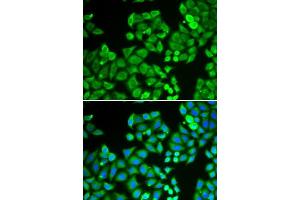 Immunofluorescence analysis of U2OS cells using PPP4C antibody. (PPP4C antibody  (AA 1-307))