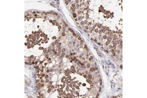 Immunohistochemical staining of human testis with NSF polyclonal antibody  shows cytoplasmic positivity in cells of seminiferus ducts at 1:50-1:200 dilution. (NSF antibody)