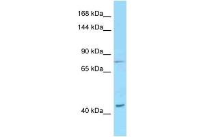 Western Blotting (WB) image for anti-Desmoglein 1 (DSG1) (C-Term) antibody (ABIN2789462) (Desmoglein 1 antibody  (C-Term))
