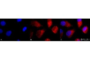 Immunocytochemistry/Immunofluorescence analysis using Rabbit Anti-TNF-R1 Polyclonal Antibody . (TNFRSF1A antibody  (AA 20-43) (Atto 594))