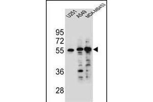 SYNCI Antibody (N-term) (ABIN654757 and ABIN2844441) western blot analysis in ,A549 and MDA-M cell line lysates (35 μg/lane). (Syncoilin antibody  (N-Term))