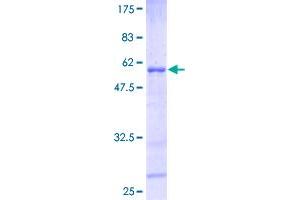 HOXB6 Protein (AA 1-224) (GST tag)