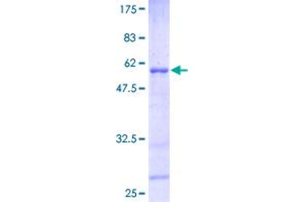 HOXB6 Protein (AA 1-224) (GST tag)