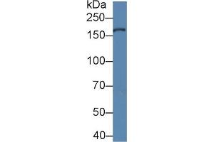 Detection of XDH in Porcine Liver lysate using Polyclonal Antibody to Xanthine Dehydrogenase (XDH) (XDH antibody  (AA 1-300))