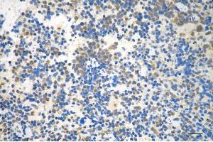 Immunohistochemistry was performed on paraffin-embedded mouse spleen using MAP2K3 antibody (ABIN7799465), 1:200).
