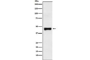Western blot analysis of LRG1 expression in Human plasma lysate.