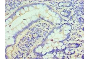 Immunohistochemistry of paraffin-embedded human small intestine tissue using ABIN7147585 at dilution of 1:100 (CLIC1 antibody  (AA 42-241))