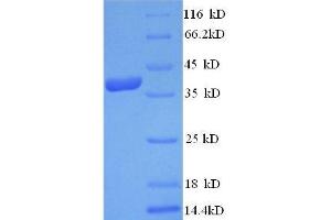 Transthyretin (TTR) (AA 21-147) protein (His tag) expressed in E.