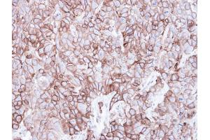 IHC-P Image Immunohistochemical analysis of paraffin-embedded FaDu xenograft, using Caveolin 2, antibody at 1:500 dilution. (Caveolin 2 antibody  (N-Term))