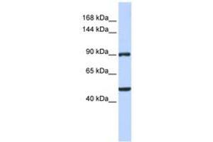 Image no. 1 for anti-Zinc Finger Protein 217 (ZNF217) (AA 540-589) antibody (ABIN6742392) (ZNF217 antibody  (AA 540-589))