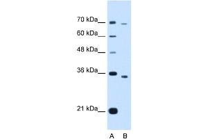 WB Suggested Anti-PHF6 Antibody Titration:  1. (PHF6 antibody  (Middle Region))
