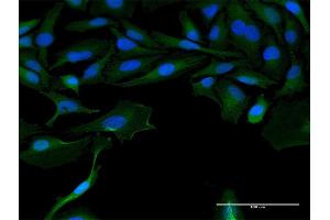 Immunofluorescence of purified MaxPab antibody to LOC541473 on HeLa cell. (LOC541473 antibody  (AA 1-131))