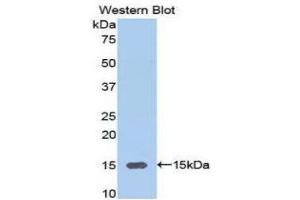 Western Blotting (WB) image for anti-Alanine Aminotransferase (ALT) (AA 367-480) antibody (ABIN1077756)