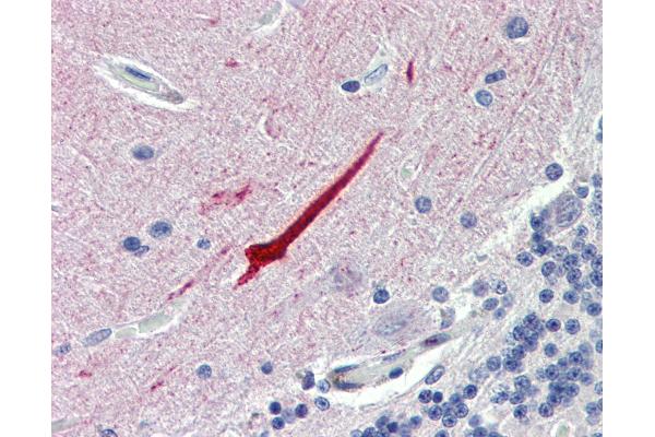 Septin 11 antibody  (N-Term)
