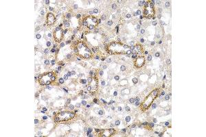 Immunohistochemistry (IHC) image for anti-CD38 (AA 1-300) antibody (ABIN1679089) (CD38 antibody  (AA 1-300))