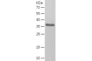 CCBP2 Protein (AA 315-384) (His-IF2DI Tag)