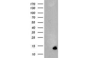Image no. 1 for anti-Chromosome 17 Open Reading Frame 37 (C17orf37) antibody (ABIN1501776) (C17orf37 antibody)