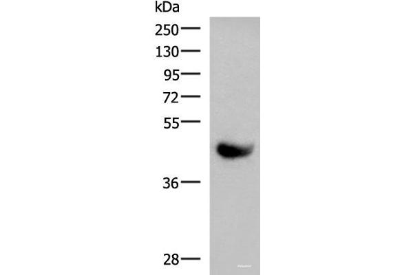 KIR2DL5A antibody