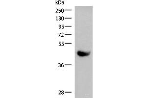 Western blot analysis of Human plasma solution using KIR2DL5A Polyclonal Antibody at dilution of 1:1000