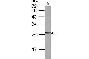 WB Image Sample (30 ug of whole cell lysate) A:NIH-3T3 12% SDS PAGE antibody diluted at 1:1000 (NME5 antibody  (Center))