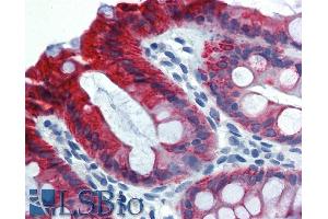 Immunohistochemistry of paraffin-embedded sections (kidney) Immunohistochemistry staining of human kidney (paraffin-embedded sections)  Fig. (Cytokeratin 18 antibody)