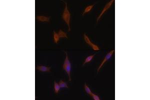 Immunofluorescence analysis of NIH-3T3 cells using MLPH antibody (ABIN6128273, ABIN6143892, ABIN6143893 and ABIN6222354) at dilution of 1:100. (Melanophilin antibody  (AA 301-600))