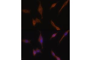 Immunofluorescence analysis of NIH-3T3 cells using MLPH antibody (ABIN6128273, ABIN6143892, ABIN6143893 and ABIN6222354) at dilution of 1:100. (Melanophilin antibody  (AA 301-600))