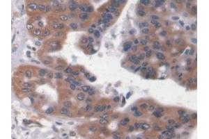 Immunohistochemistry (IHC) image for anti-Pro-Brain Natriuretic Peptide (NT-ProBNP) (NT-ProBNP) (AA 27-102) antibody (ABIN7439867)