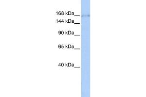 WB Suggested Anti-ZNF608 Antibody Titration:  0. (ZNF608 antibody  (Middle Region))