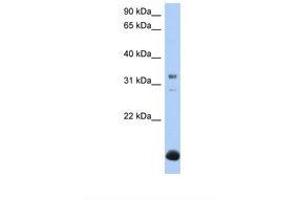 Image no. 1 for anti-UDP-Gal:betaGal beta 1,3-Galactosyltransferase Polypeptide 6 (B3GALT6) (AA 110-159) antibody (ABIN6739269) (B3GALT6 antibody  (AA 110-159))