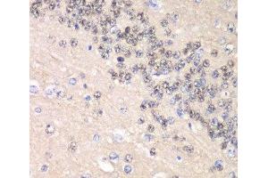Immunohistochemistry of paraffin-embedded Rat brain using CCNC Polyclonal Antibody at dilution of 1:100 (40x lens).
